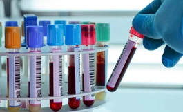 How to Increase Productivity of Your Laboratory?