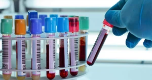 How to Increase Productivity of Your Laboratory?