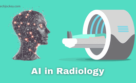 The Impact of AI in Radiology on Modern Healthcare