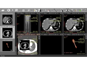 RadiAnt DICOM Viewer-monitoring