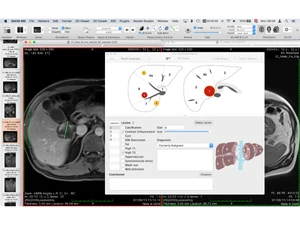 OsiriX MD-2d viewer