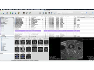 OsiriX MD-dashboard