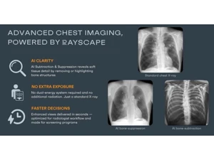 Rayscape-chest imaging