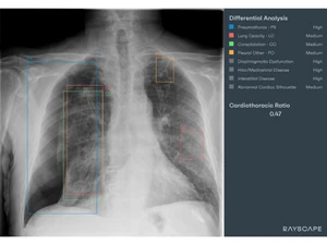 Rayscape-lung analysis