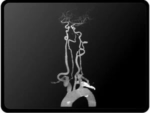 RapidAI-3D reconstruction