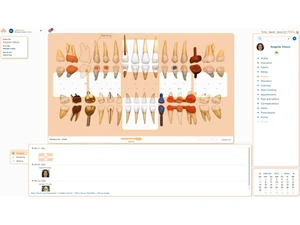 curve dental software-chart