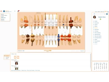 curve dental software-chart