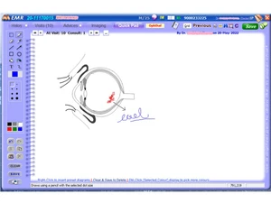 blooray medico quick pad