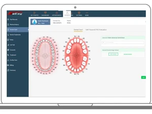 soezy pharmacy software-dental chart