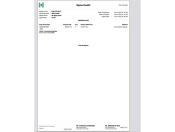 sigma invoices