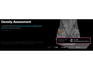 Lunit Density Assessment