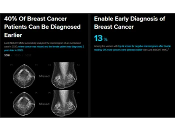 Lunit Early Diagnosis