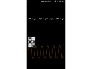 InFormant Speech Analytics Voice