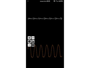 InFormant Speech Analytics Voice