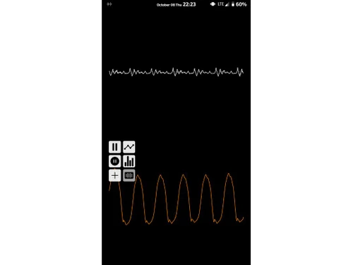 InFormant Speech Analytics Voice