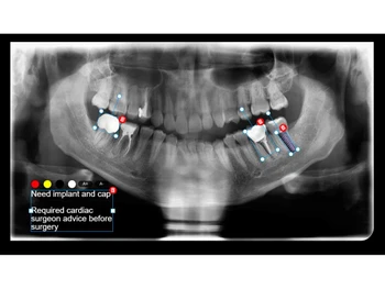 Care and Treatment dental