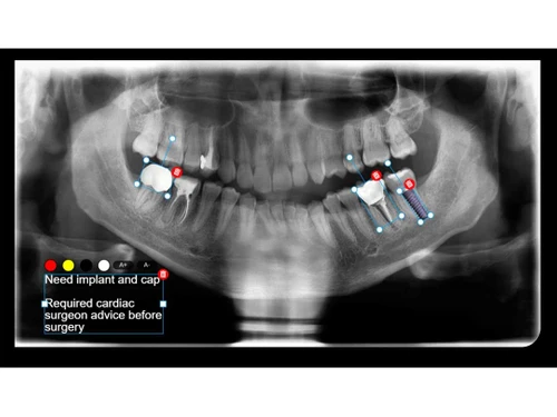 Care and Treatment dental
