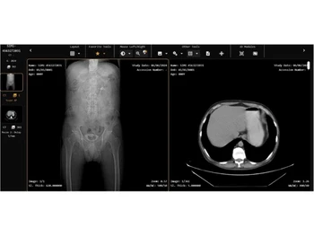 Simplirad radiologists