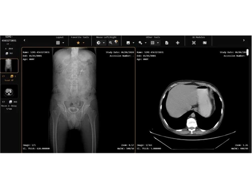 Simplirad radiologists