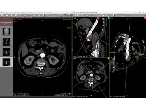 RadiAnt DICOM Viewer-MPR