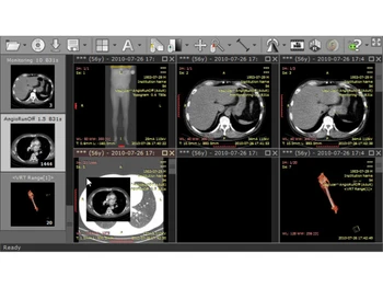 RadiAnt DICOM Viewer-monitoring