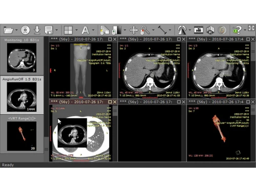 RadiAnt DICOM Viewer-monitoring