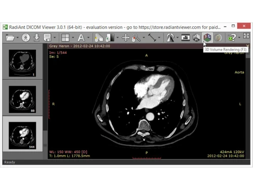 RadiAnt DICOM Viewer-rendering