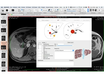 OsiriX MD-2d viewer