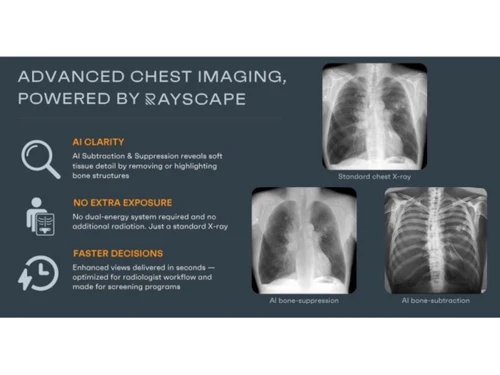 Rayscape-chest imaging