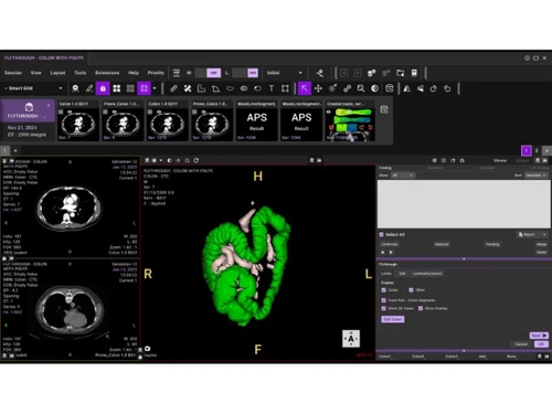 DeepHealth-3D imaging