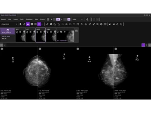 DeepHealth-cloud native