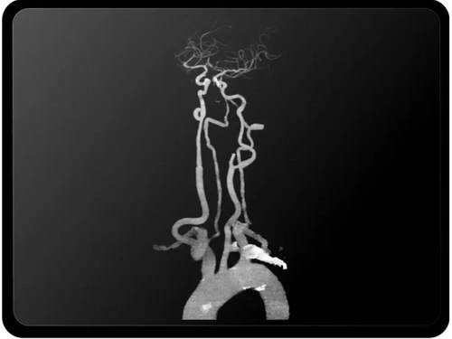 RapidAI-3D reconstruction