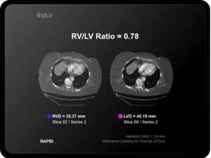 RapidAI-cardiopulmonary