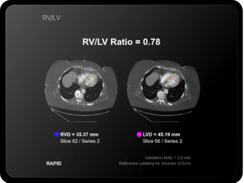 RapidAI-cardiopulmonary