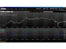 Money.Net-charts